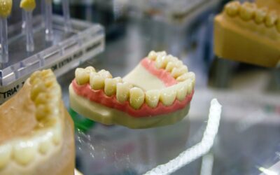 Understanding Teeth Stains: Types, Causes, and Treatments