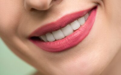 These Signs Will Tell You That You Need a Smile Makeover!